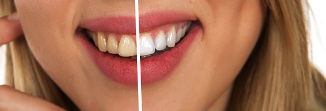 3 mýty o zubnej paste, ktorým všetci veríme od detstva